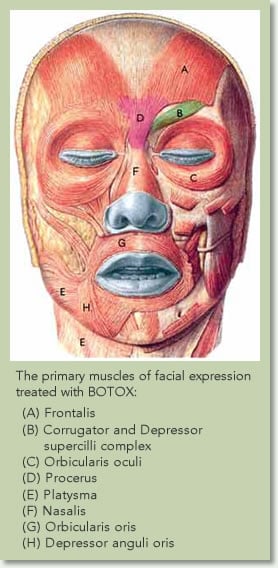 nonsurgical botox cosmetic